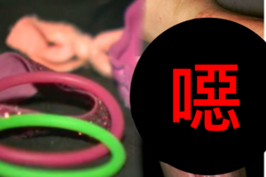 女子只是把髮圈套在自己的手腕上 隔天竟然就出現了一個不堪入目的傷口！知道原因後實在不敢相信...