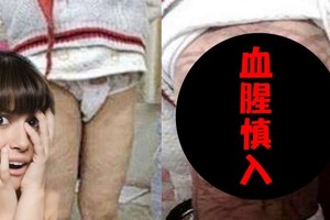 這名中國女子只因孩子不寫作業而毒打他一頓 全身上下的傷口...讓人看得好氣憤、心疼...