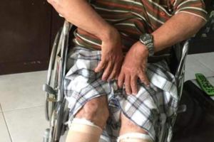 【盤骨爆裂黎維信安哥愁手術費】【醫生建議儘快做手術，需要3萬手術費】【安哥無能為力只好向大眾求助】