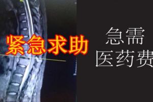 【緊急求助】22歲活潑愛笑女孩化療後再度患癌醫藥卡全數用完急需90千手術醫藥費