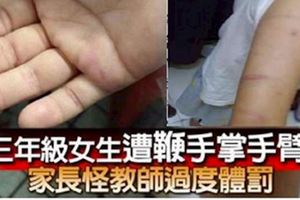 三年級女生遭鞭手掌手臂家長怪教師過度體罰