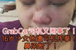 【GrabCar司機又鬧事了！】16歲少女慘遭司機揮拳！鼻樑斷了！