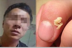 每次跟女友親熱，都會聞到「怪怪的味道」！帶她去看醫生之後，我都被嚇死了…