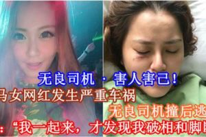 【無良司機·害人害己！】大馬女網紅發生嚴重車禍，無良司機撞後逃跑！網紅：「我一起來，才發現我破相和腳斷！」