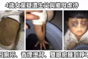 4歲女童疑遭生父與繼母虐待，遭囚廁所、香煙燙背、雙眼瘀腫到睜不開