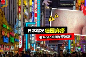 東京最為嚴重！日本爆發「德國麻疹」感染人數上千！短期內最好避免不要去！