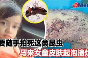 不要隨手拍死這類昆蟲，馬來女童皮膚起泡潰爛！《內附視頻》