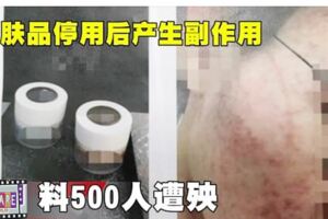 護膚品停用後產生副作用　料500人遭殃！