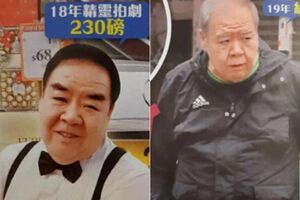 肥貓鄭則仕受糖尿病纏身，日漸消瘦頭髮斑白身體堪憂