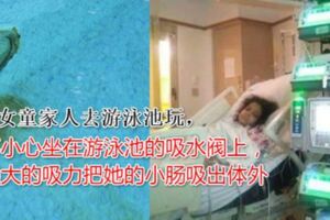 不小心坐到泳池的吸水閥女小腸慘被吸水閥吸出來