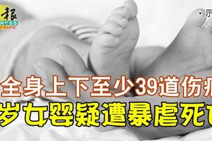 全身上下至少39道傷痕1歲女嬰疑遭暴虐死亡