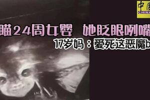 掃瞄24周女嬰她眨眼咧嘴笑17歲媽：愛死這惡魔baby