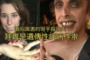女孩將手指彎曲到令人無法置信的地步 但是當我們知道背後的原因後都哭了...