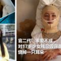 官二代」求愛不成，對17歲少女殘忍毀容面目全非，燒掉一隻耳朵