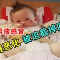 警惕！2歲男孩感冒發燒惡化被迫截掉四肢!