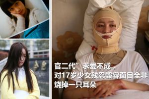 官二代」求愛不成，對17歲少女殘忍毀容面目全非，燒掉一隻耳朵