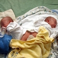 人妻懷孕5個月，做產檢竟發現雙胞胎有異狀