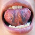 血管堵不堵，看看舌頭就知道了！火麻仁泡水喝，除淤通血不堵塞！