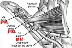 病「微」苦卻「重」的腱鞘炎：自測、護理與預防治療大全