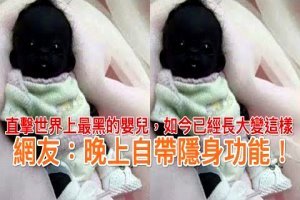 直擊世界上最黑的嬰兒，如今已經長大變這樣，網友：晚上自帶隱身功能！ 