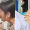 學生牙齒卡進椅子腳！慘被緊緊夾住