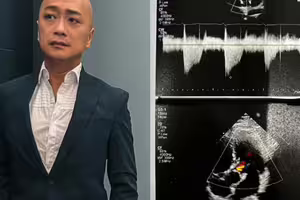 男星「心臟瓣膜少1片」仍服役2年！昔為挺兄弟遭關禁閉