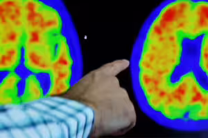 很容易做到!研究曝「3招」真能防癌、防失智 醫師也激推 很容易做到!研究曝「3招」真能防癌、防失智 醫師也激推