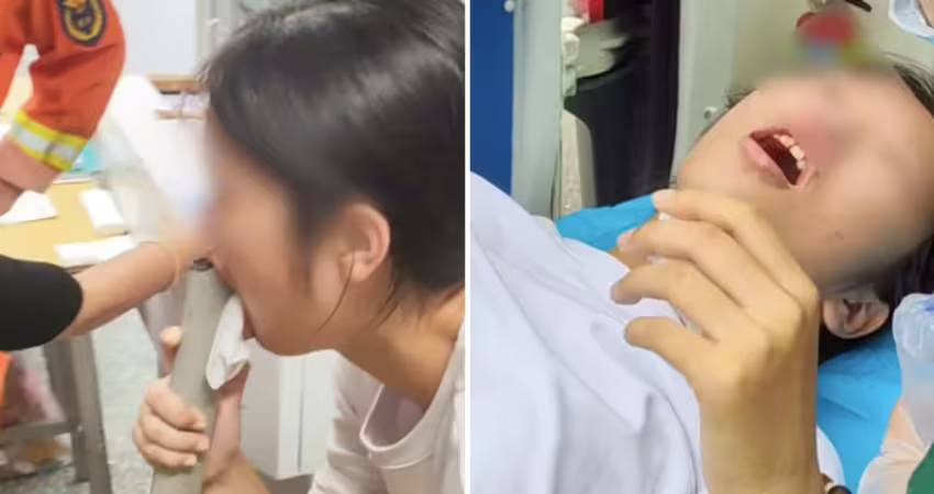 學生牙齒卡進椅子腳！慘被緊緊夾住