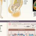 肥胖管理 | NEJM