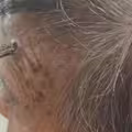 98歲嬤「頭上長角」！竟「自行剪斷」急送醫　驚人真相曝光