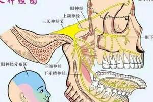 三叉神經痛苦不堪言，原因？怎麼應對呢？