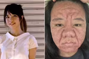 28歲女因懷孕「樣貌大變」！生產完近況曝