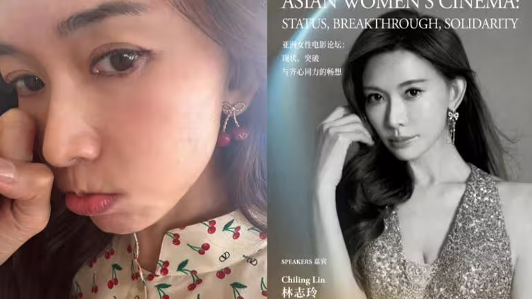 林志玲出發前往坎城影展前,臉大過敏起紅疹。(圖/翻攝自IG、微博) 林志玲出發前往坎城影展前,臉大過敏起紅疹。(圖/翻攝自IG、微博)