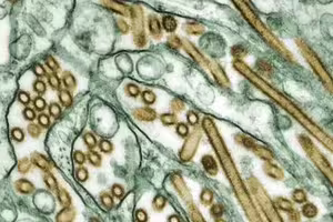 全球首宗!人類感染H5N5 患者最新情況曝 全球首宗!人類感染H5N5 患者最新情況曝