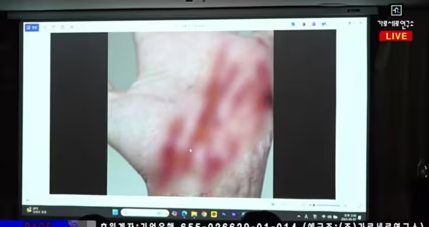 金賽綸留1.5hrs錄音！金秀賢「開天價」收買失敗 爆料者遭襲身中9刀