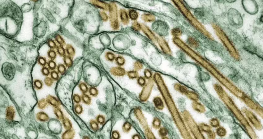 全球首宗！人類感染H5N5　患者最新情況曝