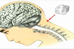 把「冰塊」放在脖子的這個穴道上不但能治頭痛，居然還有這麼多「驚人的好處」！