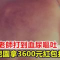 男童被老師打到血尿嘔吐幼兒園拿3600元紅包打發