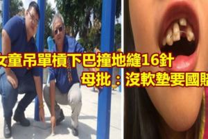 女童吊單槓下巴撞地縫16針母批：沒軟墊要國賠