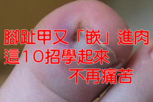 腳趾甲又「嵌」進肉裡，讓你痛苦不已嗎？快把這１０個妙招學起來，以後再也不擔心了！