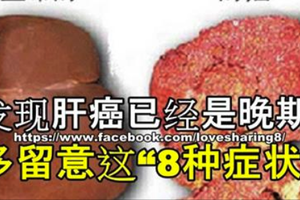 肝癌不痛不癢？但發現之後已經是晚期！只有多留意這「8種症狀」，才能挽救你的命！