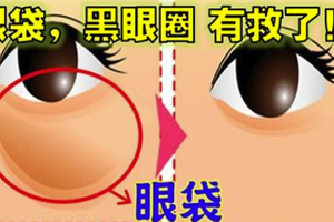 眼袋、黑眼圈有救了！天然免開刀、每天這麼做不花半小時，馬上逆齡10歲！ 