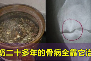 地主家祖傳治骨質增生土方，奶奶二十多年的骨病全靠它治癒！轉發一次，功德無量~ 