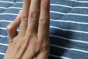 日本網友：有誰的小手指比我更像魯魯修的？引發網友競相模仿