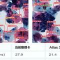 人工智慧技術已在宮頸癌篩查中大顯身手