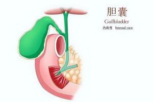 膽囊並非可有可無，切除後對身體有什麼影響？醫生告訴你真相