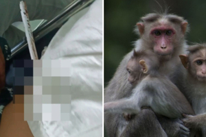 少女遭猴群攻擊　「鋼條刺穿身體」1小時才被發現