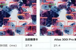 人工智慧技術已在宮頸癌篩查中大顯身手