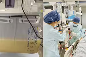 40歲男酒後急送加護　「血抽出來變牛奶色」醫嘆：重症了
