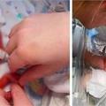 5個多月早產女嬰被封「紅色外星人寶寶」嚇壞父母！醫生差點放棄她「1年後模樣」萌翻全球！！